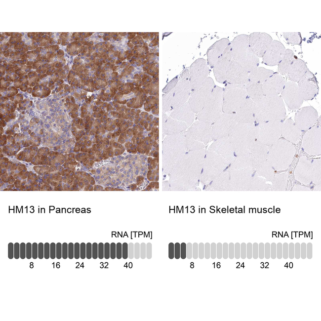 HM13 Antibody in Immunohistochemistry (Paraffin) (IHC (P))