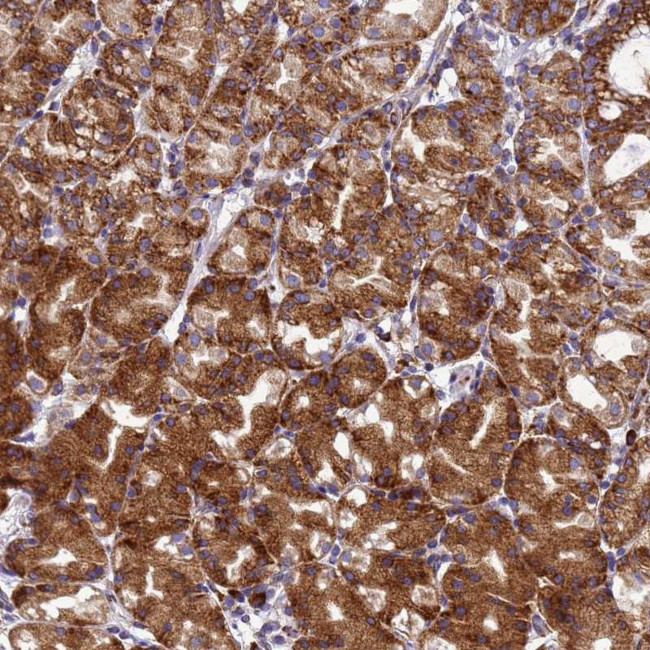 EEF1D Antibody in Immunohistochemistry (Paraffin) (IHC (P))