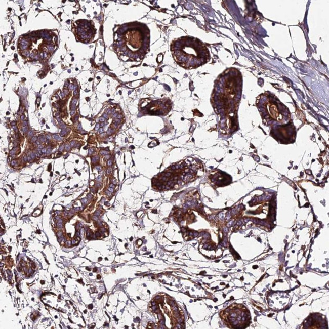 BEX4 Antibody in Immunohistochemistry (Paraffin) (IHC (P))