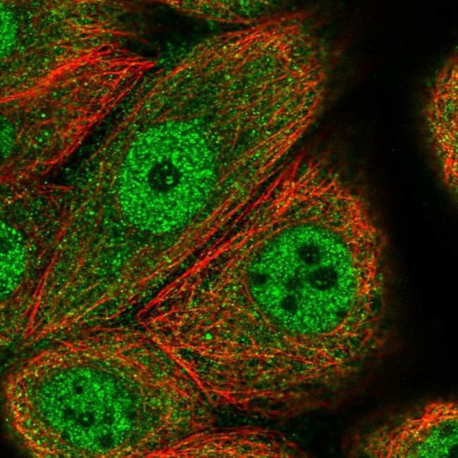 CCDC112 Antibody in Immunocytochemistry (ICC/IF)