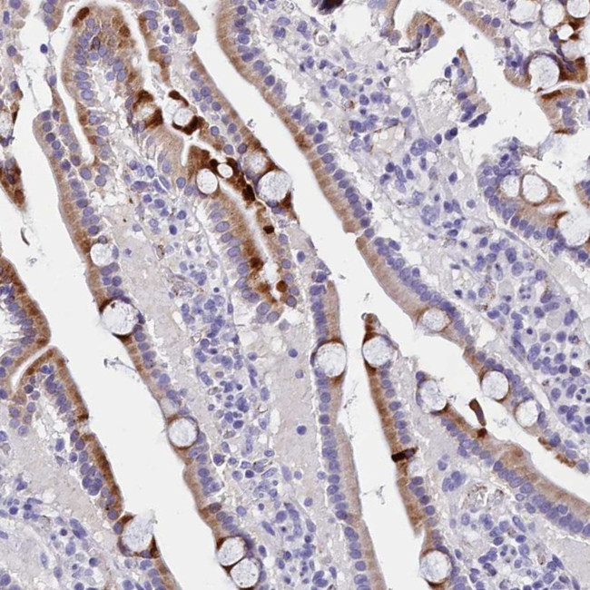 MS4A18 Antibody in Immunohistochemistry (Paraffin) (IHC (P))