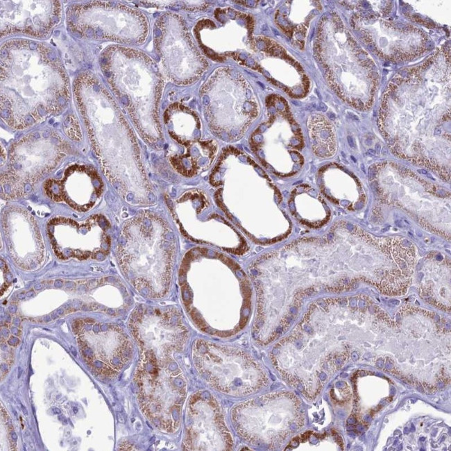 C21orf140 Antibody in Immunohistochemistry (Paraffin) (IHC (P))