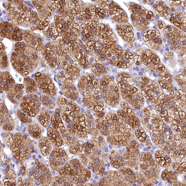 TIMM22 Antibody in Immunohistochemistry (Paraffin) (IHC (P))