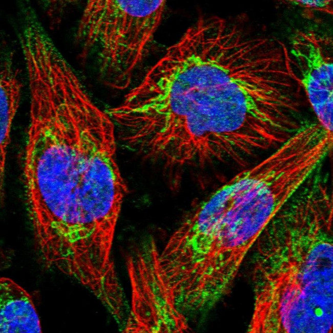 ABCB8 Antibody in Immunocytochemistry (ICC/IF)