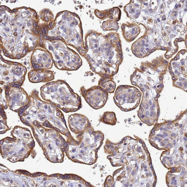 ADPGK Antibody in Immunohistochemistry (Paraffin) (IHC (P))