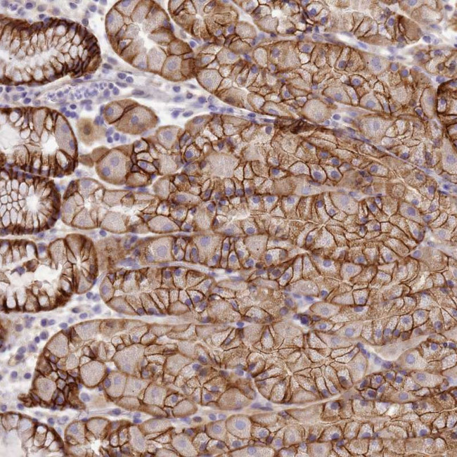 TBCD Antibody in Immunohistochemistry (Paraffin) (IHC (P))