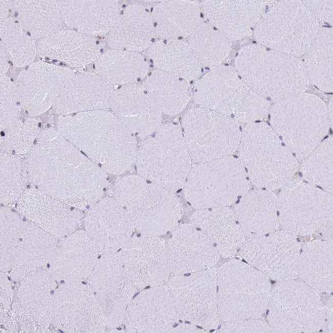 SSR4 Antibody in Immunohistochemistry (Paraffin) (IHC (P))