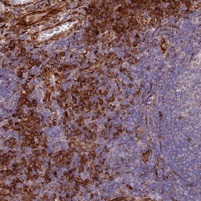NDUFAF7 Antibody in Immunohistochemistry (Paraffin) (IHC (P))