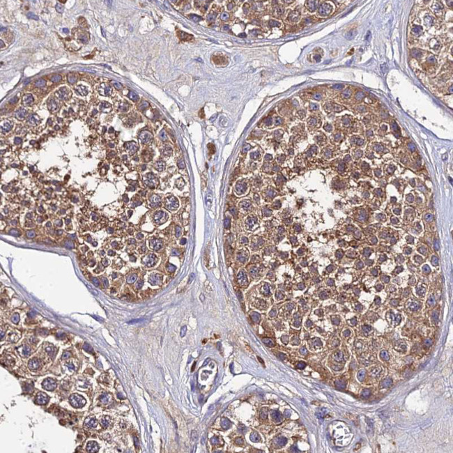 C2orf69 Antibody in Immunohistochemistry (Paraffin) (IHC (P))