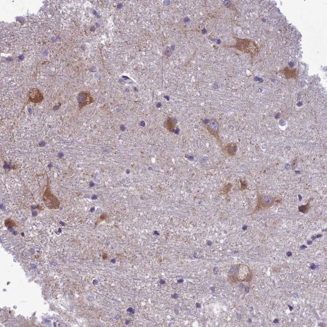 PCDHB14 Antibody in Immunohistochemistry (IHC)
