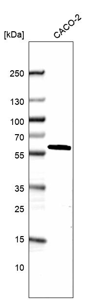 DDX19A Antibody in Western Blot (WB)