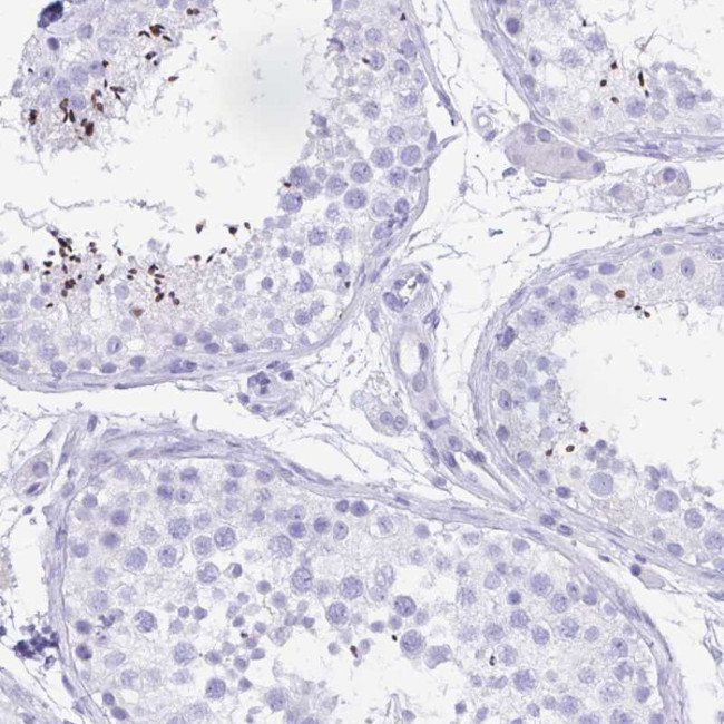 CATSPER4 Antibody in Immunohistochemistry (Paraffin) (IHC (P))