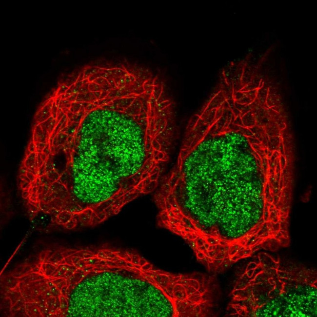 UBXN2B Antibody in Immunocytochemistry (ICC/IF)