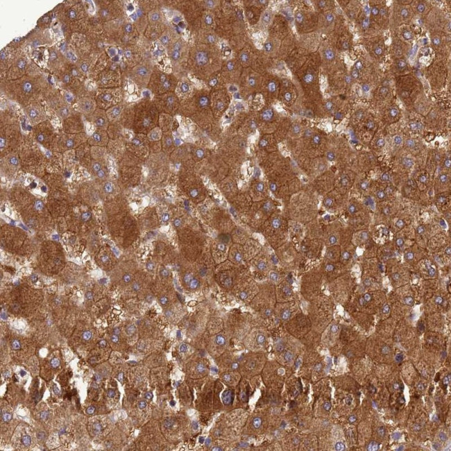 ADAMTS7 Antibody in Immunohistochemistry (Paraffin) (IHC (P))