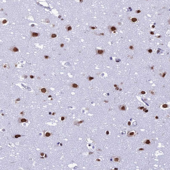 PRAMEF12 Antibody in Immunohistochemistry (Paraffin) (IHC (P))