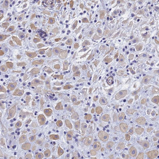 TRIM64B Antibody in Immunohistochemistry (Paraffin) (IHC (P))
