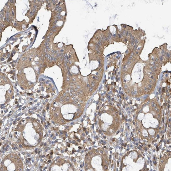 BOLA2 Antibody in Immunohistochemistry (IHC)