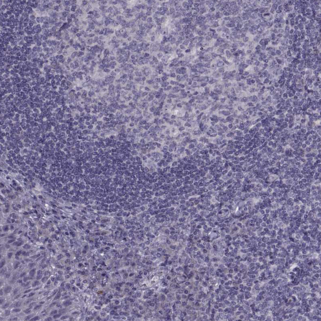 RSPH6A Antibody in Immunohistochemistry (Paraffin) (IHC (P))