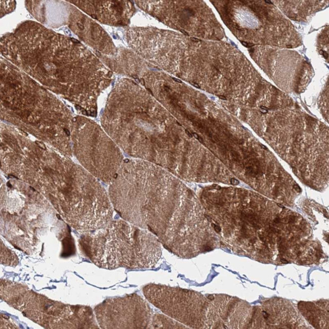 C5orf34 Antibody in Immunohistochemistry (Paraffin) (IHC (P))