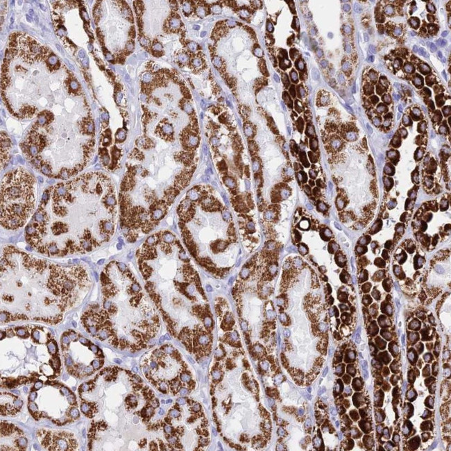 PKN3 Antibody in Immunohistochemistry (Paraffin) (IHC (P))