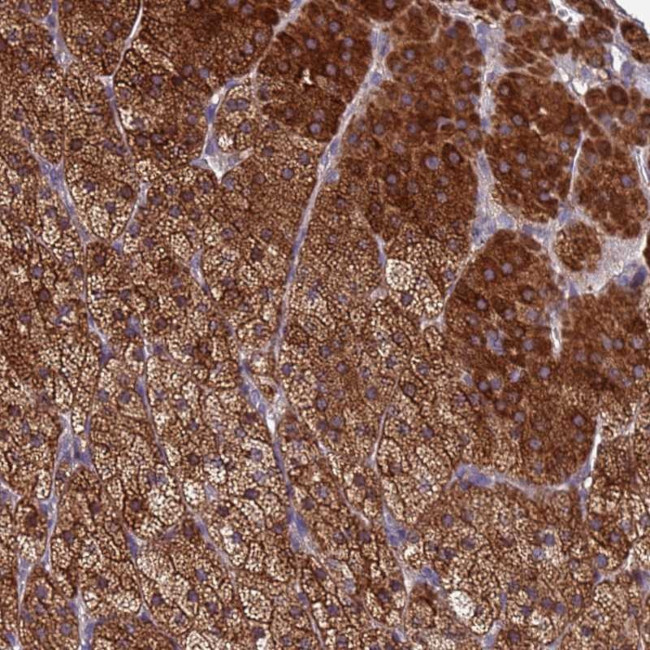 CLHC1 Antibody in Immunohistochemistry (Paraffin) (IHC (P))