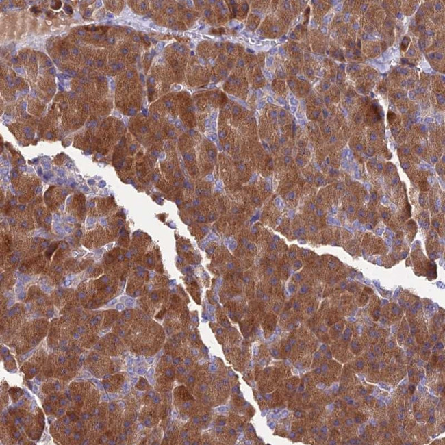 COMMD10 Antibody in Immunohistochemistry (Paraffin) (IHC (P))