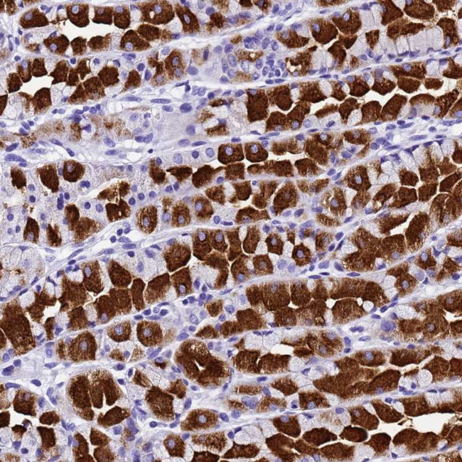 HERC4 Antibody in Immunohistochemistry (Paraffin) (IHC (P))
