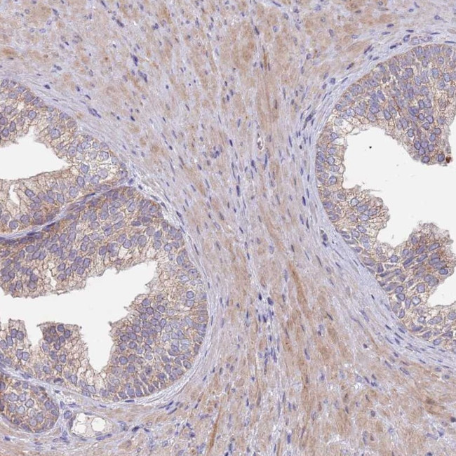 MRP7 Antibody in Immunohistochemistry (Paraffin) (IHC (P))