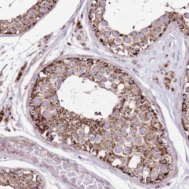 HECTD4 Antibody in Immunohistochemistry (Paraffin) (IHC (P))