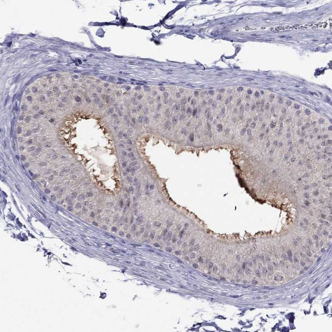 MYO3B Antibody in Immunohistochemistry (IHC)