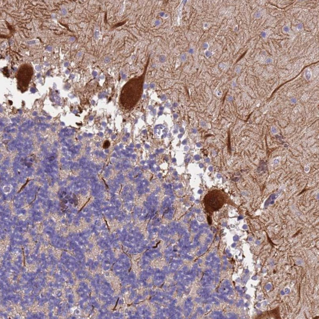 SLC24A3 Antibody in Immunohistochemistry (Paraffin) (IHC (P))
