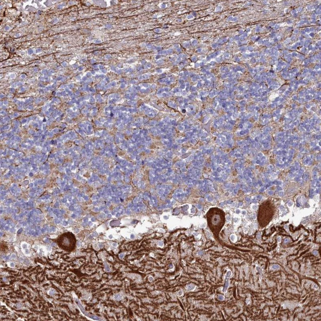 KCTD18 Antibody in Immunohistochemistry (Paraffin) (IHC (P))