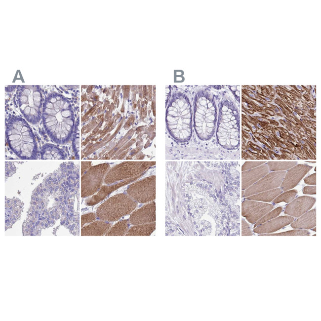 Sarcalumenin Antibody in Immunohistochemistry (IHC)