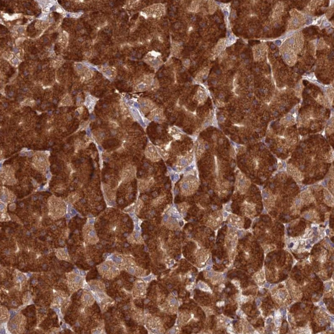 NXNL2 Antibody in Immunohistochemistry (Paraffin) (IHC (P))