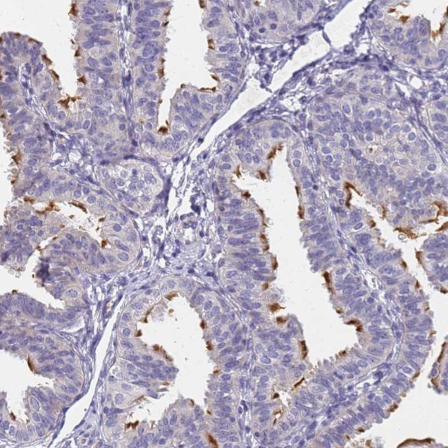 FAM166B Antibody in Immunohistochemistry (Paraffin) (IHC (P))