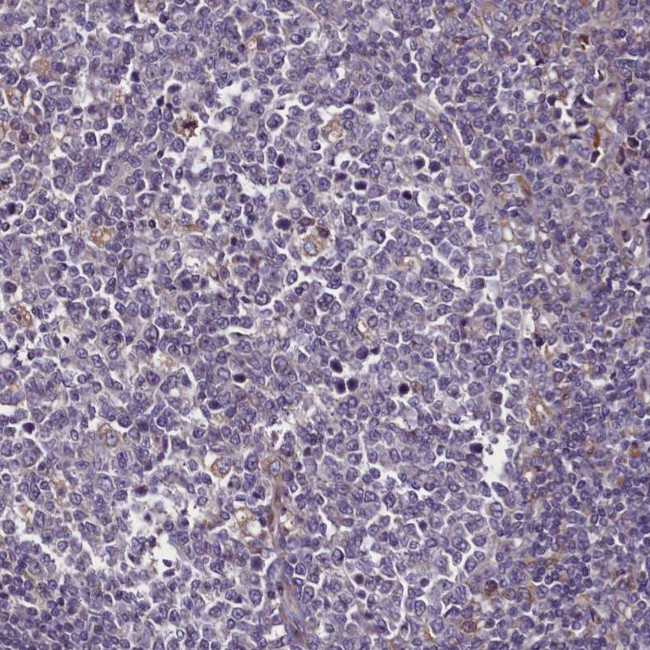 FAM195B Antibody in Immunohistochemistry (Paraffin) (IHC (P))