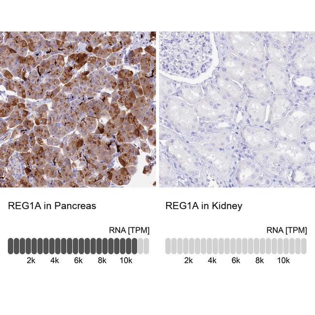 REG1A Antibody in Immunohistochemistry (Paraffin) (IHC (P))