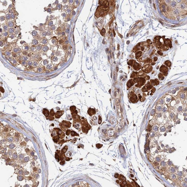 OR14J1 Antibody in Immunohistochemistry (Paraffin) (IHC (P))