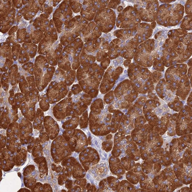 TCP-1 zeta Antibody in Immunohistochemistry (Paraffin) (IHC (P))