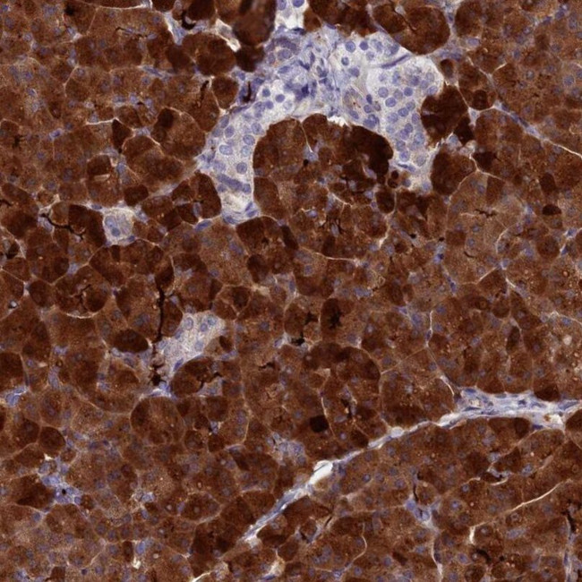 REG1A Antibody in Immunohistochemistry (IHC)