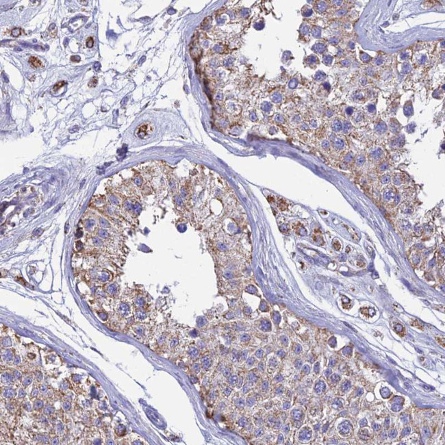 OR2W3 Antibody in Immunohistochemistry (Paraffin) (IHC (P))
