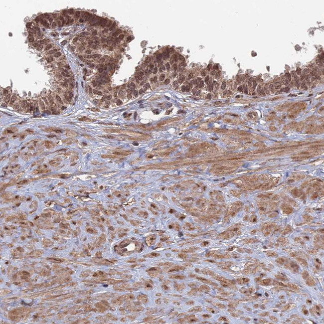 CNTD2 Antibody in Immunohistochemistry (Paraffin) (IHC (P))
