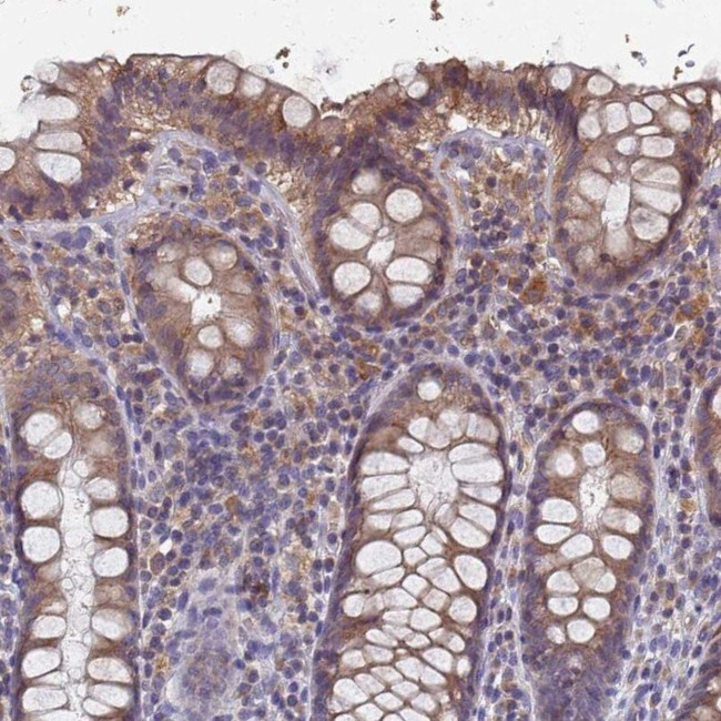 KRCC1 Antibody in Immunohistochemistry (IHC)