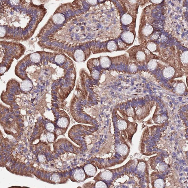 ARHGEF35 Antibody in Immunohistochemistry (Paraffin) (IHC (P))