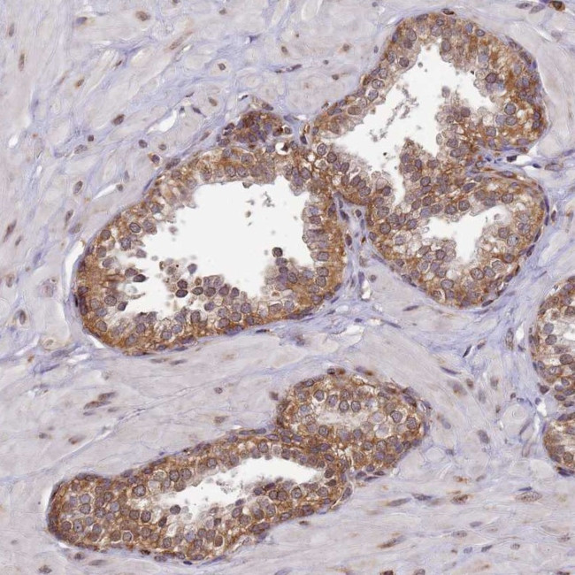 CCDC9 Antibody in Immunohistochemistry (Paraffin) (IHC (P))