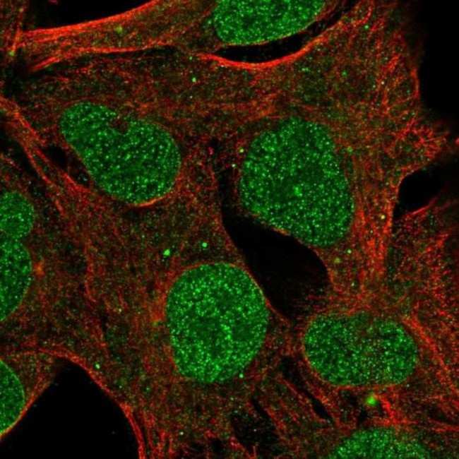 ZNF626 Antibody in Immunocytochemistry (ICC/IF)