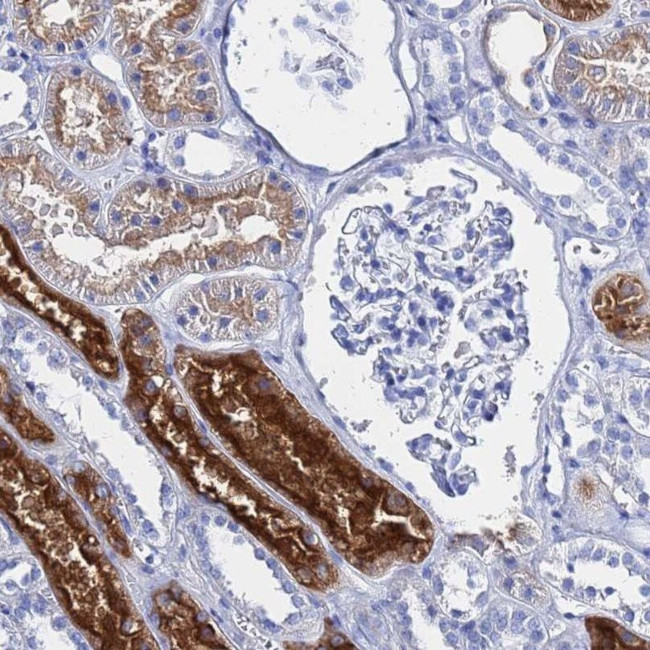 GGT2 Antibody in Immunohistochemistry (IHC)