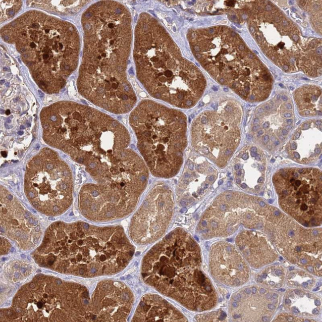 SLC35E2B Antibody in Immunohistochemistry (Paraffin) (IHC (P))