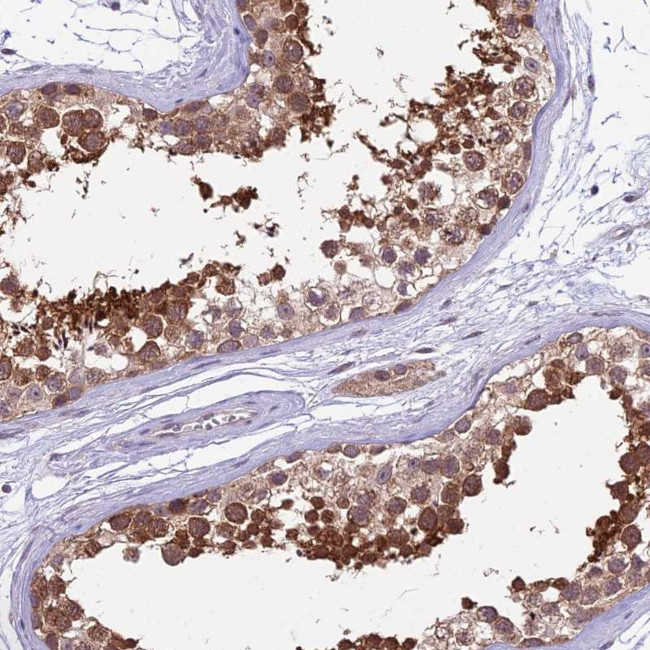 SPATA33 Antibody in Immunohistochemistry (Paraffin) (IHC (P))