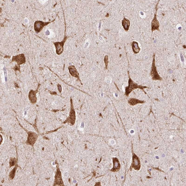 FMC1 Antibody in Immunohistochemistry (Paraffin) (IHC (P))